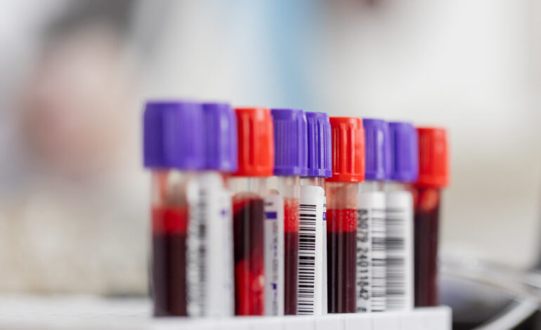 Prefeitura realiza campanha de doação de sangue nos dias 2,16 e 17 junho
