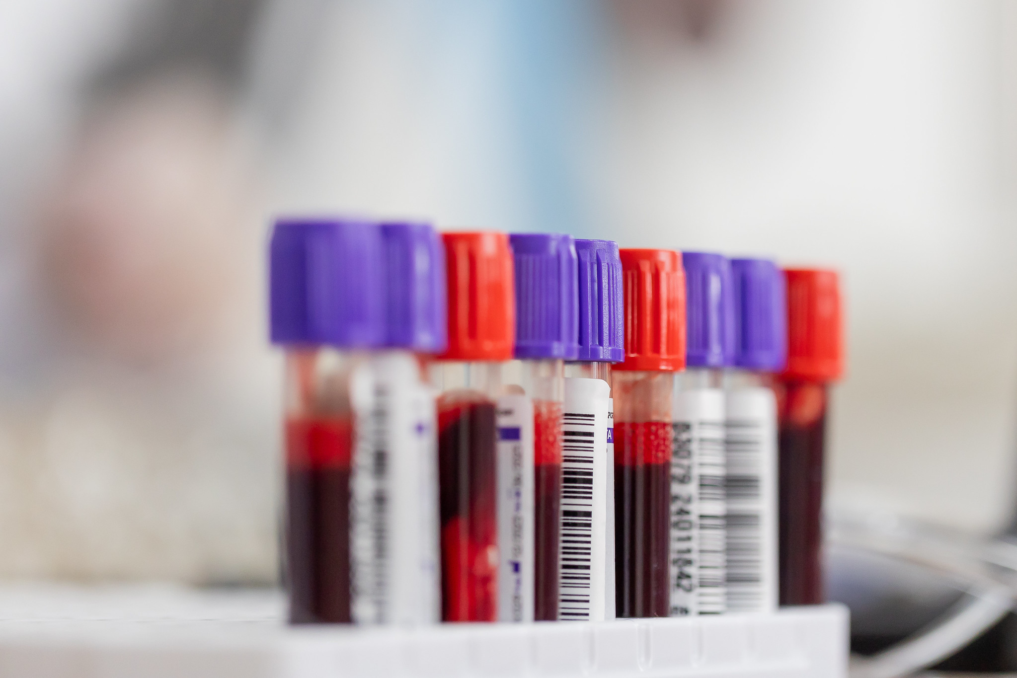 Prefeitura realiza campanha de doação de sangue nos dias 2,16 e 17 junho